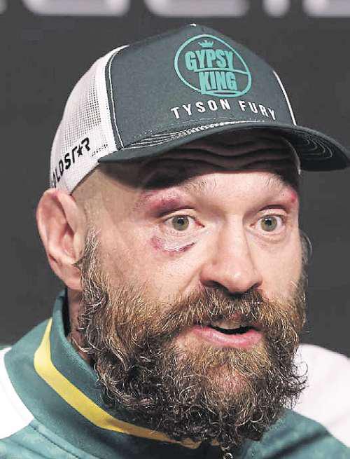 Promoter Arum claims Fury won't come back