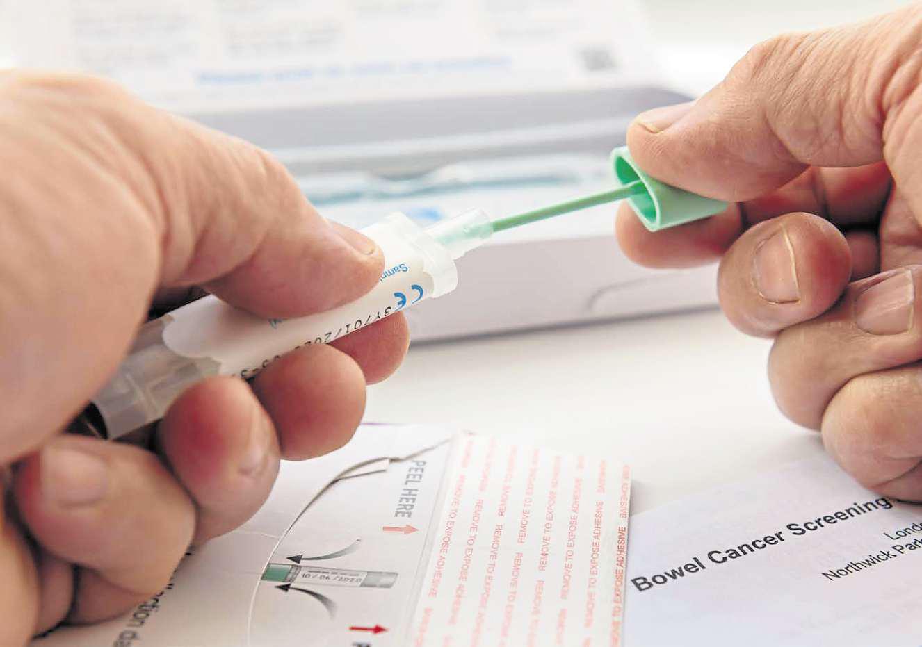 Exercise, diet and a poo test lowers risk of bowel cancer