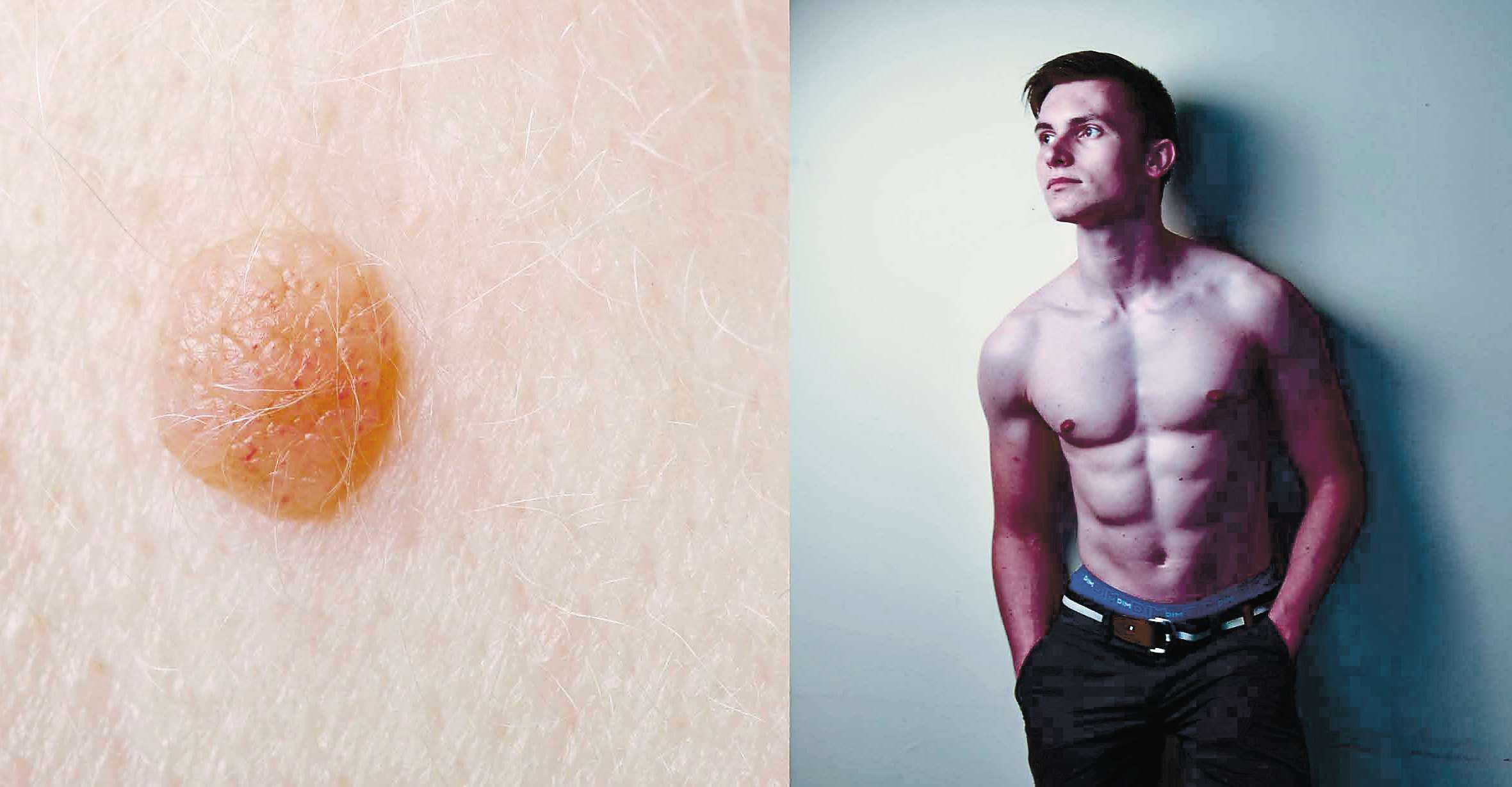 Wart's going on for our Steve? He's got to get this off his chest