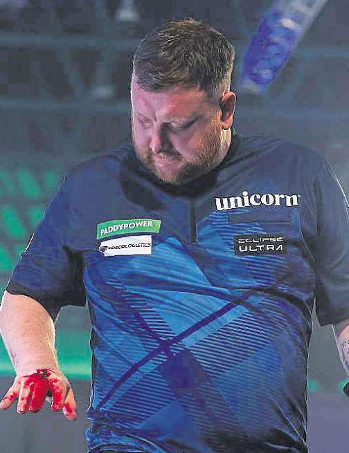 I'm sorry for my reaction after defeat - Menzies