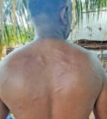 குடும்பிமலைப் பகுதியில் சிவில் சமூக செயற்பாட்டாளர் மீது தாக்குதல்
