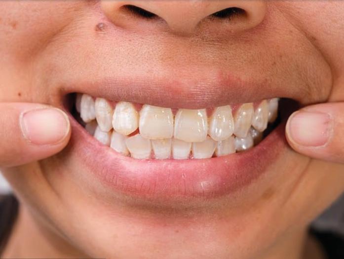 உங்களைப் பற்றி உங்கள் பற்கள் கூறும்