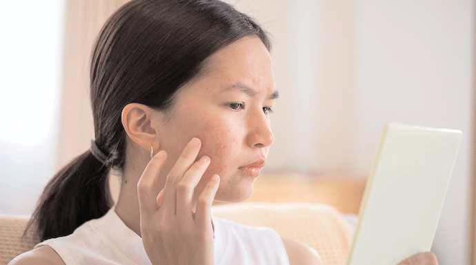 Can omega-3 fatty acid intake affect acne severity?