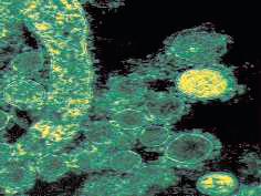 Antibiotics after birth affects gut microbes of babies, study finds