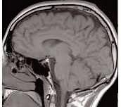 Researchers develop new drug-delivery system to treat brain disorders