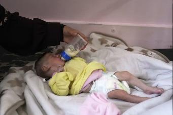 Mothers and their babies face starvation in Gaza, where hospitals are overwhelmed
