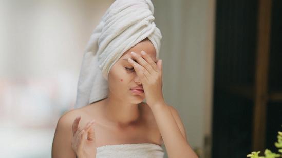Sudden acne breakouts? Dermat shares 5 habits that help prevent flare-ups