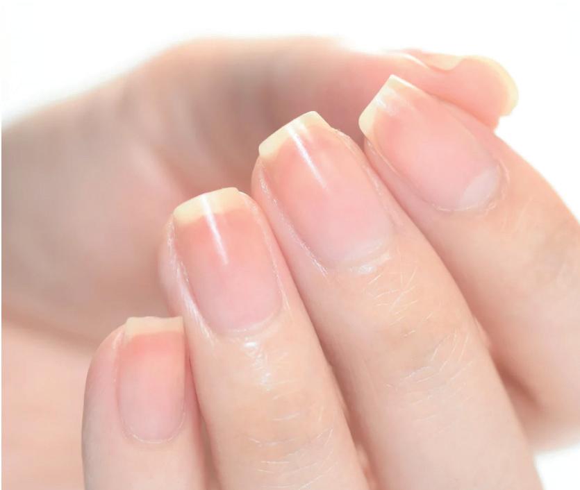 Want to save your nails from damage this summer?