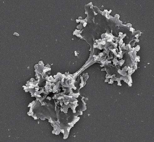 Fiery Amoeba