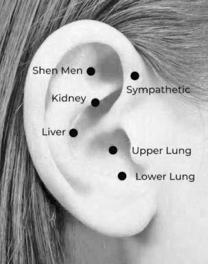 Ear acupuncture offers relief from stress, emotional distress